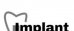 ImplantLive (ИмплантЛайф)